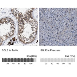SQLE Antibody, Novus Biologicals 0.1mL; Unlabeled:Antibodies, Polyclonal